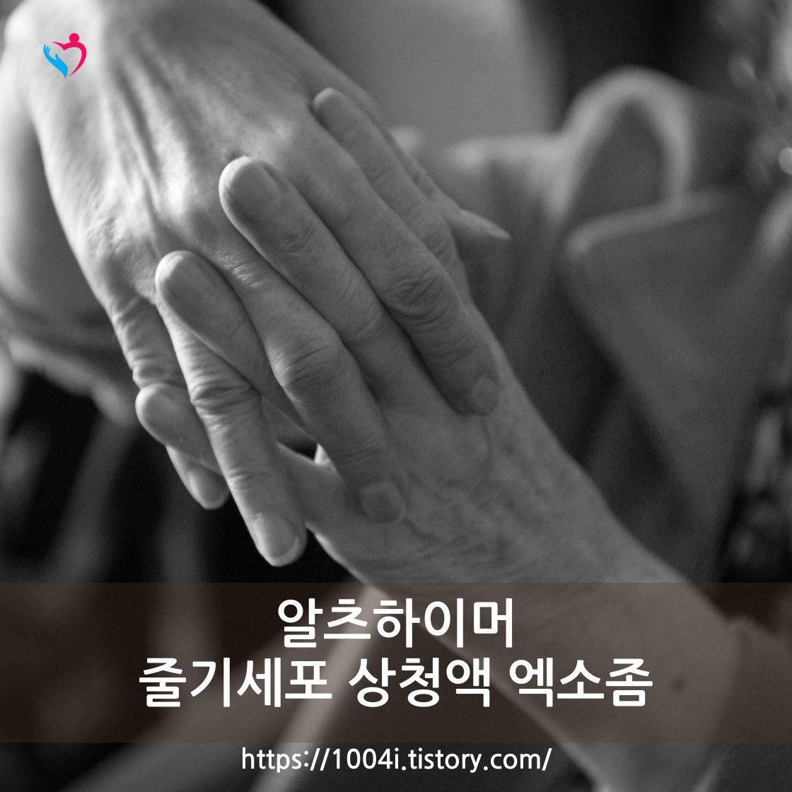 알츠하이머성 치매 뇌 신경 질환