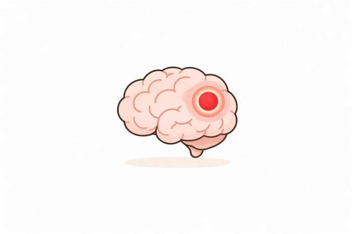 암환자 산정특례 제도