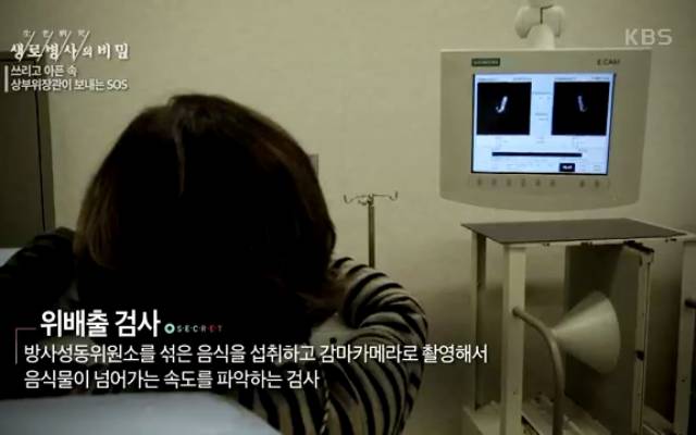 소화 안되고 트림 속쓰림 기능성소화불량 생로병사의비밀