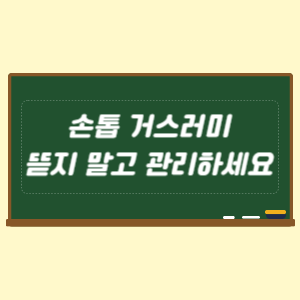 손톱 거스러미 뜯지 말고 관리하는 방법