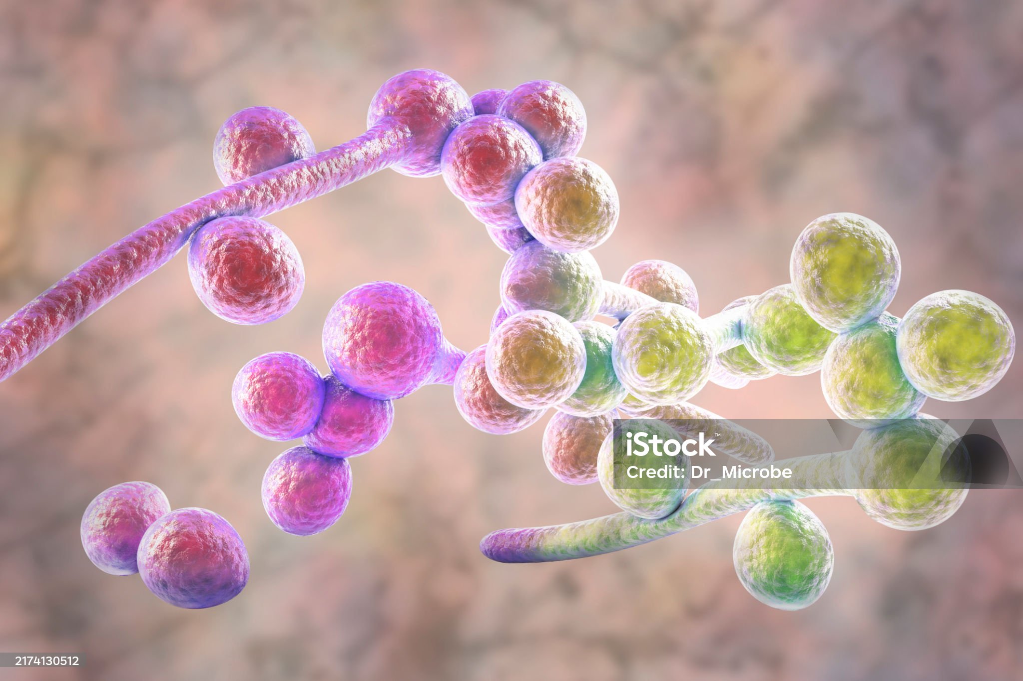 질염-관련-사진