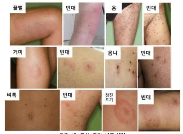 모기 물려 가려울 때 땀띠에 안티푸라민 연고 효능 부작용 사용후기_1