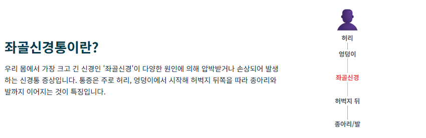 좌골신경통 덩이와 다리가 저릿한 통증 증상, 원인 및 치료 방법