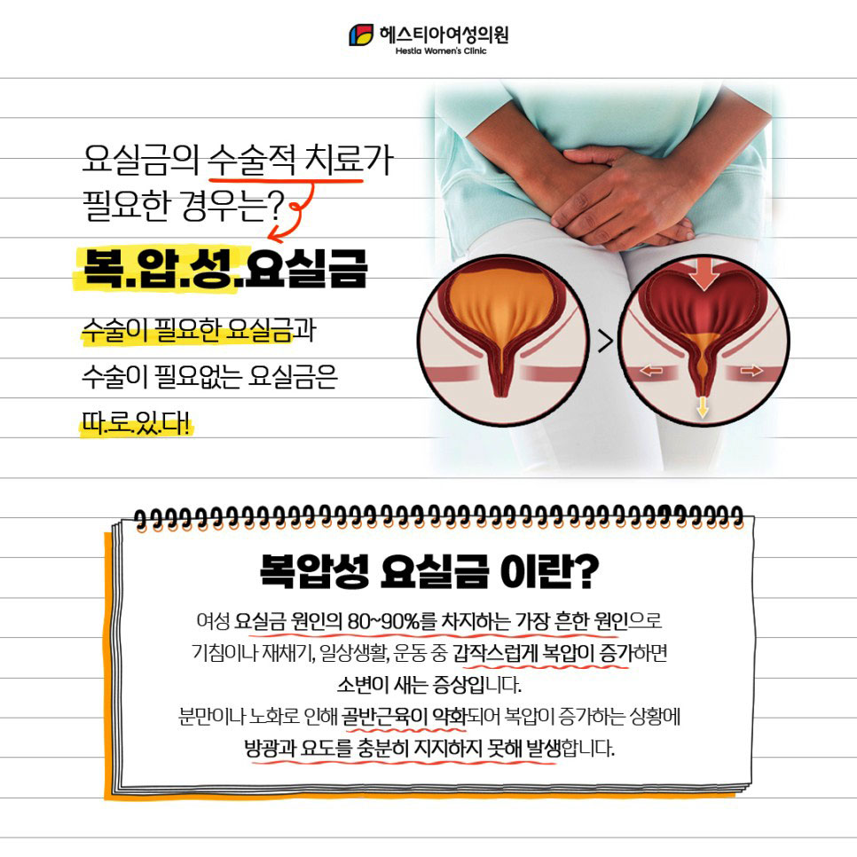 복압성요실금이란?