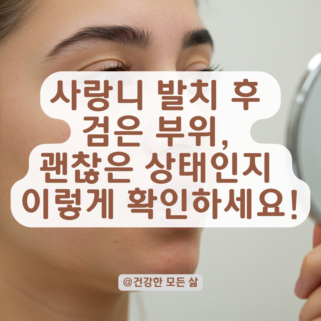 사랑니 발치 부위 검게 변했다면, 괜찮은 상태인지 확인하는 방법.