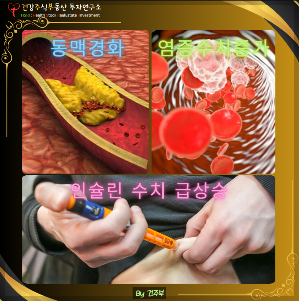 아스파탐이 건강에 미치는 영향 : 동맥경화, 염증수치증가 ,인슐린 수치 급상승