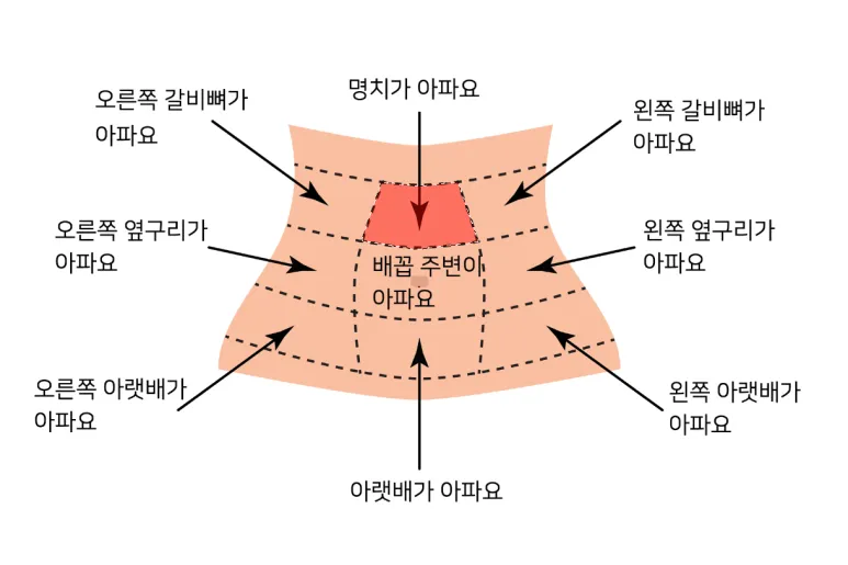 명치끝이 아픈이유 종류별 낫는법까지 완벽 해결_2