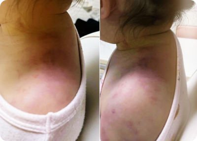 경기도-안산-어린이집-아동학대