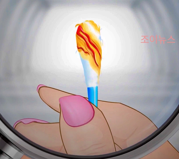 (검)붉은 귀지_출처:유튜브더팁