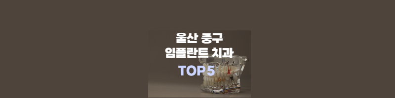 울산-중구-임플란트-치과추천-썸네일