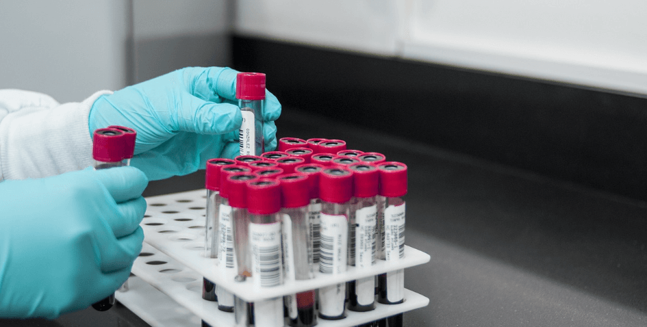 혈액 검사와 관련 된 사진들 - 2