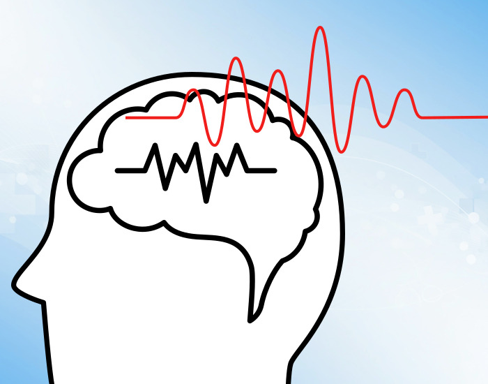 뇌파 측정 그림