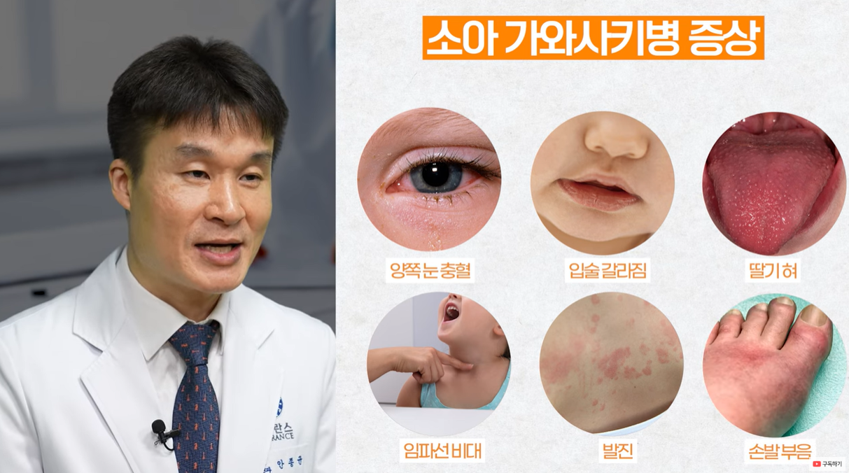 소아 가와사키병의 증상