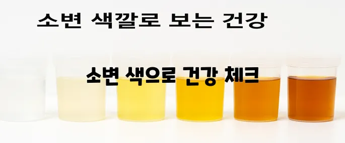 소변 색깔로 보는 건강 한번에 알아보기