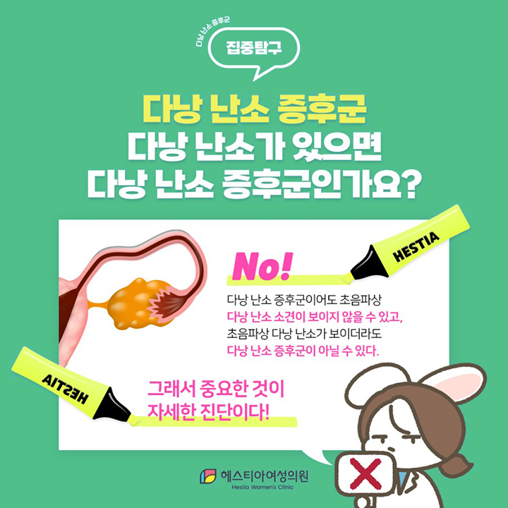 다낭 난소가 있으면 다낭 난소 증후군인가요?