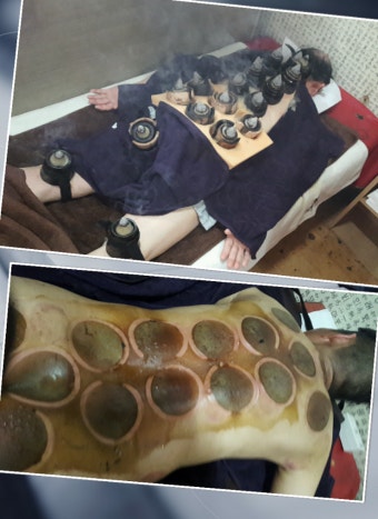 집에서 쑥뜸 하는 방법 : 초보자를 위한 안전 가이드