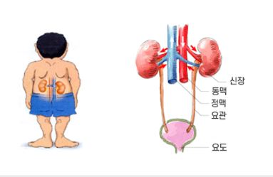 신장이 안좋으면 나타나는 증상