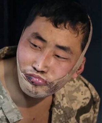 젤렌스키 포로 송환