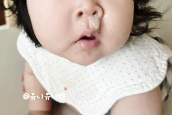 수족구 어른 전염에 대한 원인과 예방법 정리_21