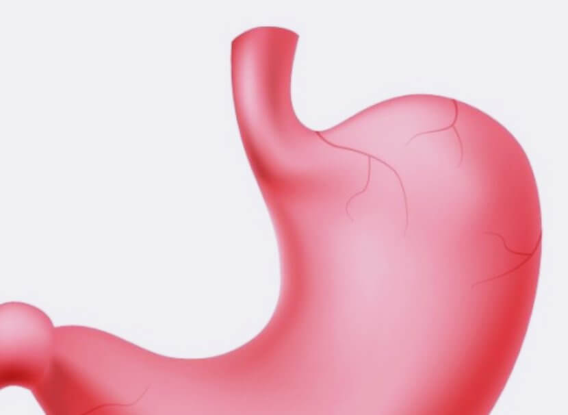 핑크색-위장을-표현한-그림