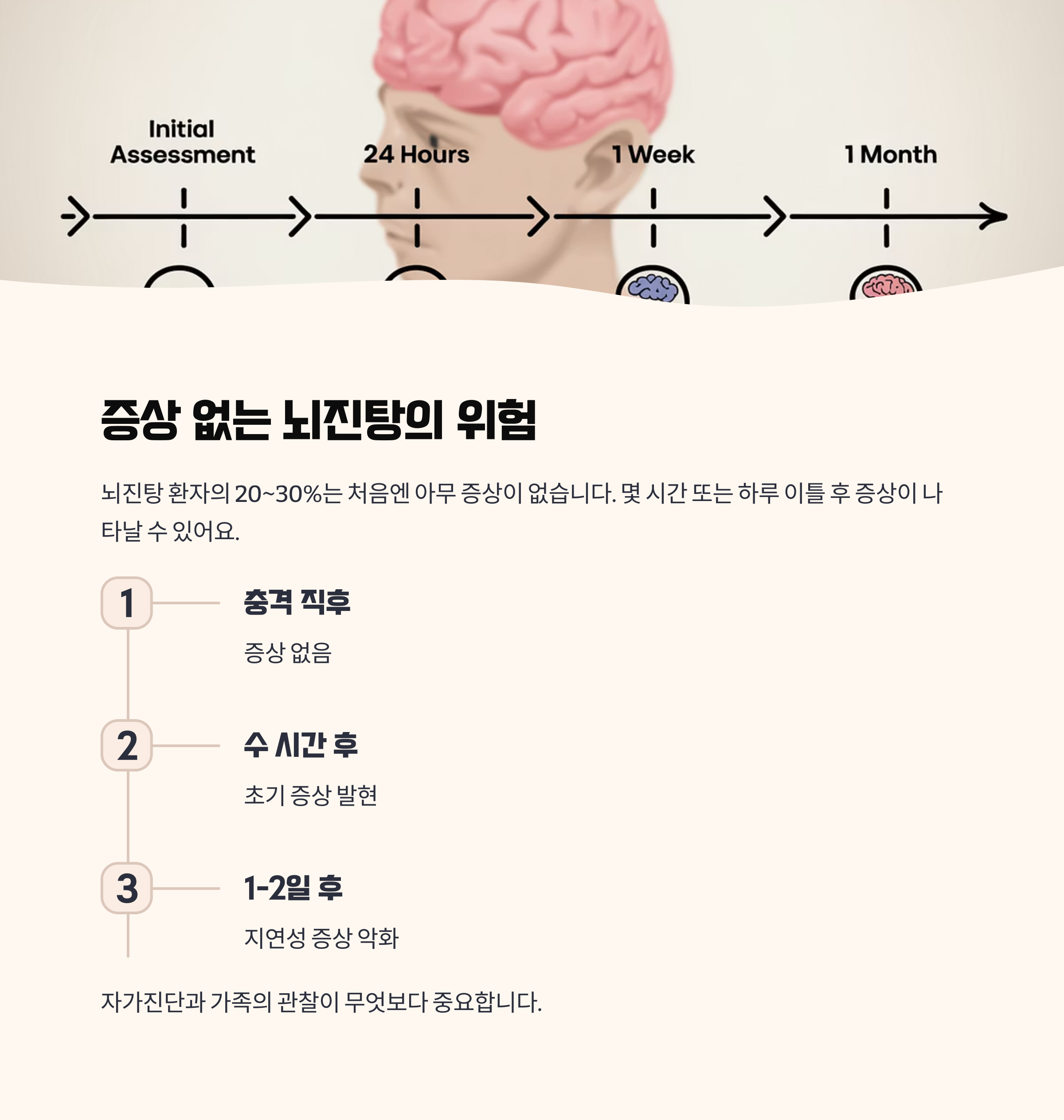 증상이 없더라도 뇌진탕일 수 있는 이유