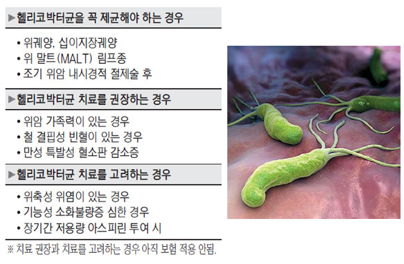헬리코박터균 증상 치료 해결책
