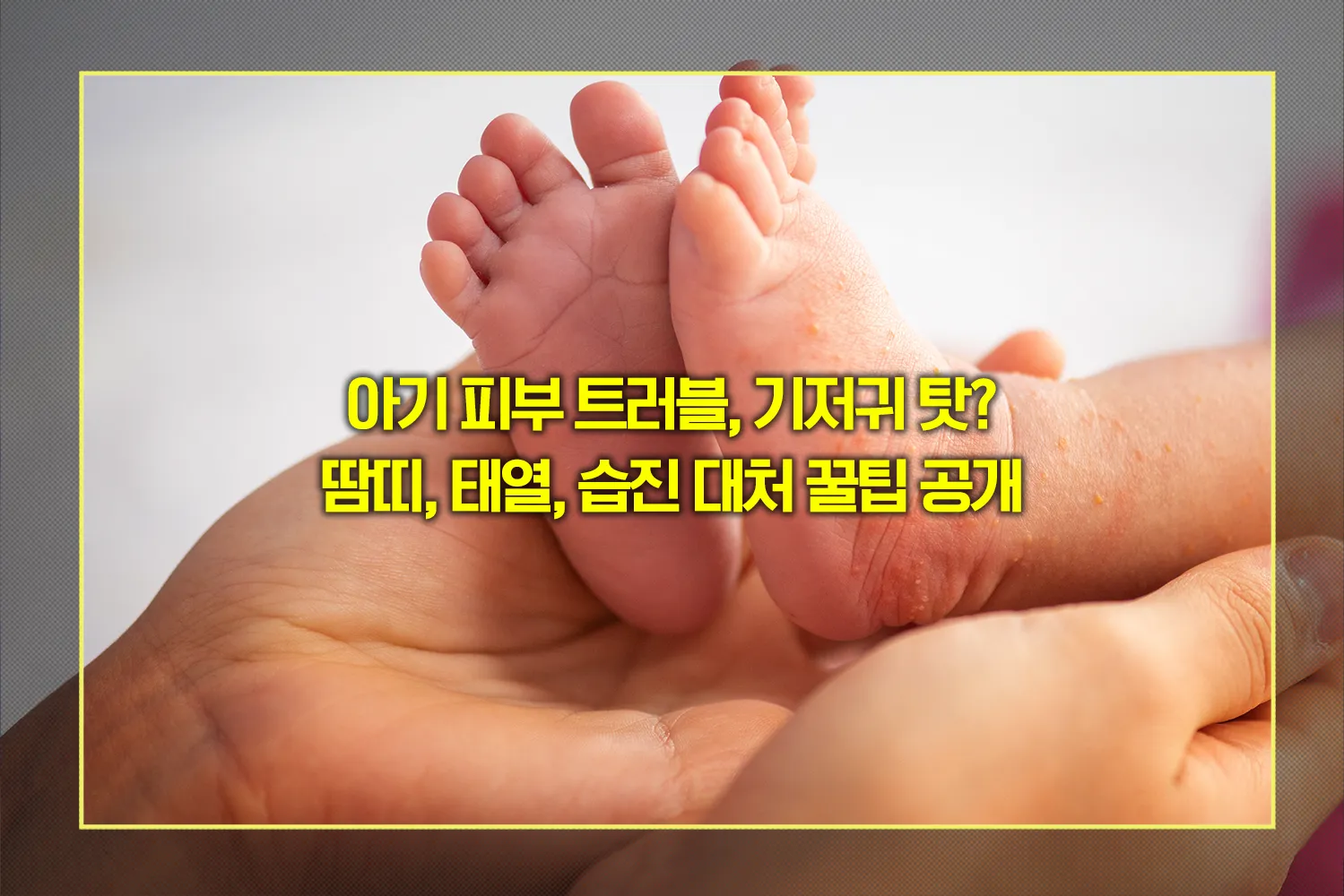 아기-피부트러블-예방과-기저귀선택