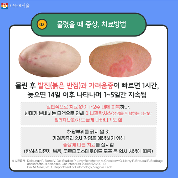 빈대