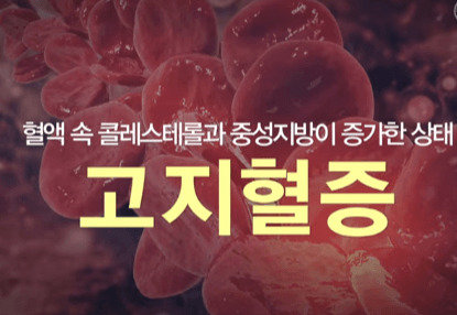 고지혈증