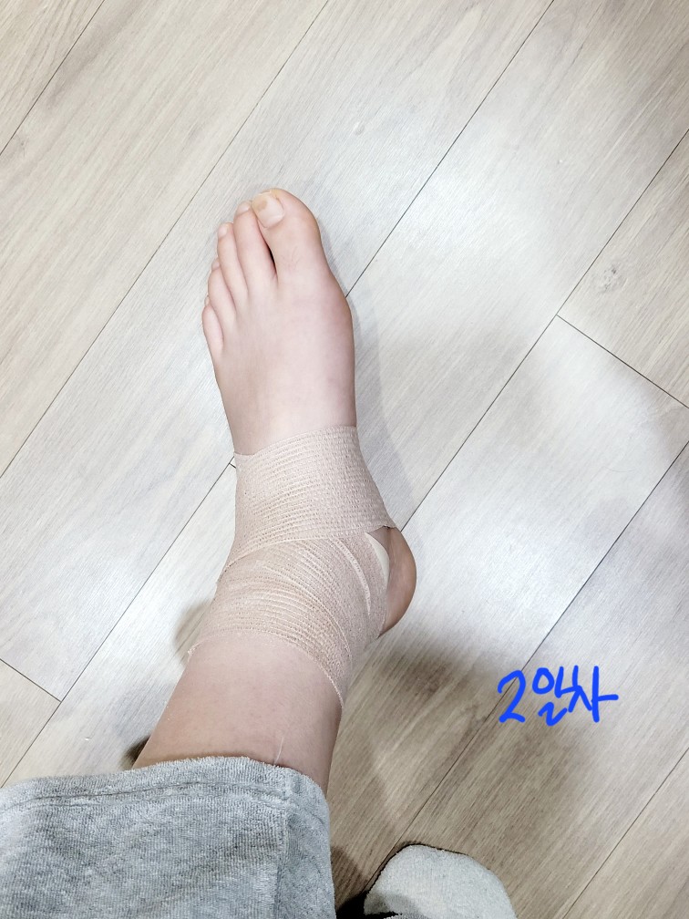 발목-접질렀을-때