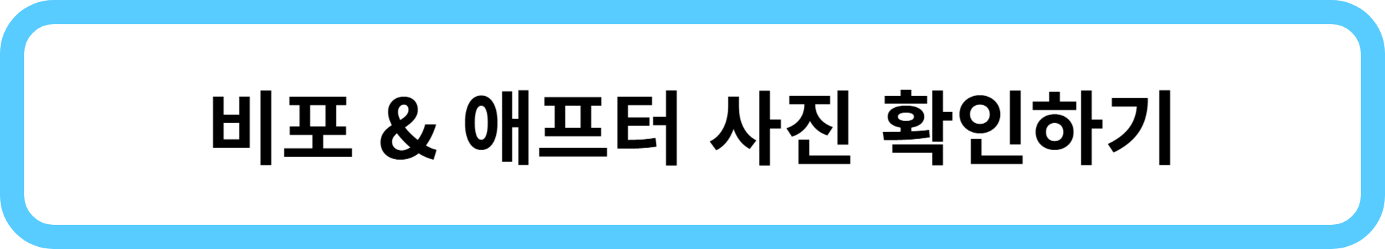 침샘 보톡스 효과&middot;주기&middot;가격&middot;후기 총정리