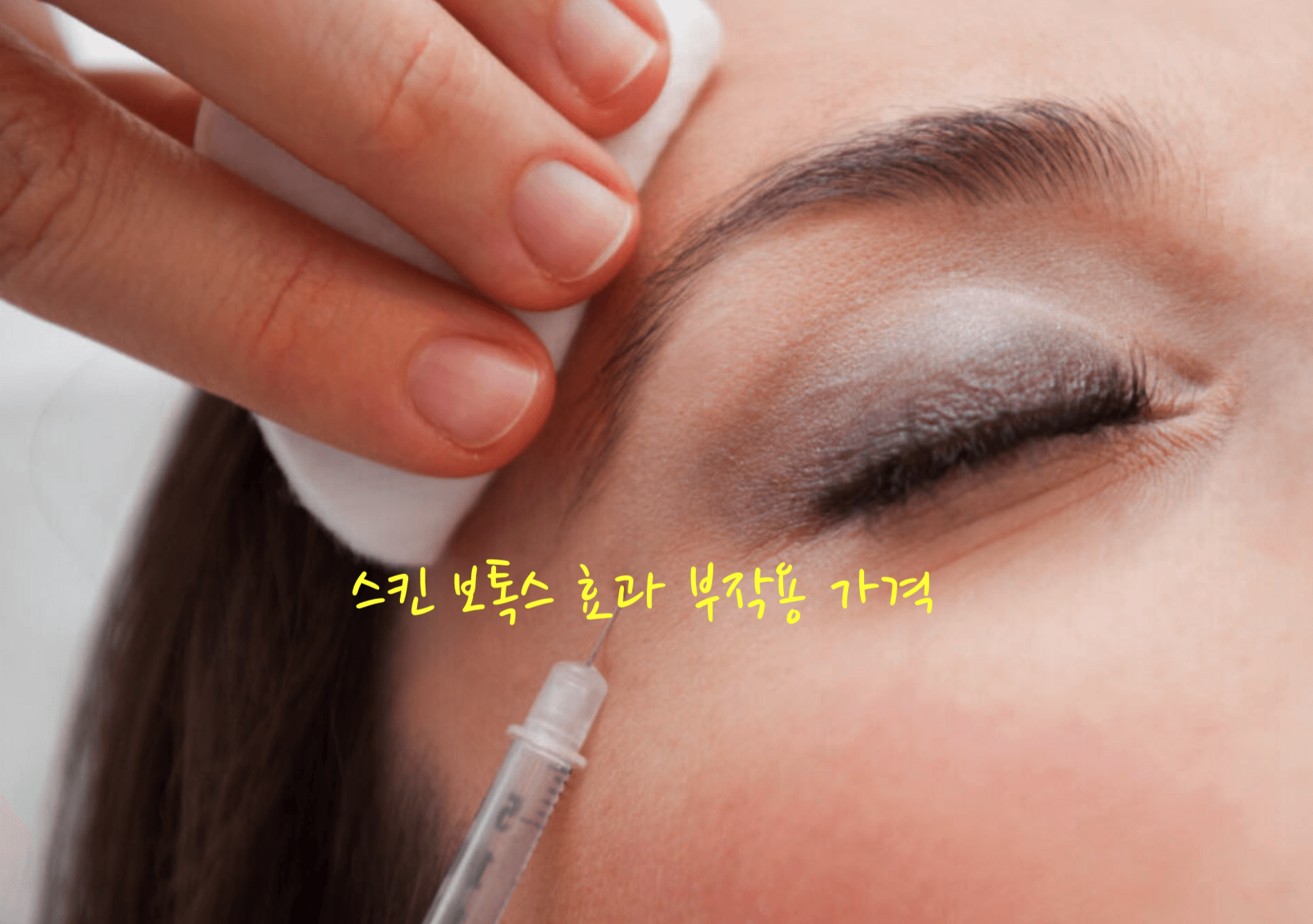 스킨 보톡스