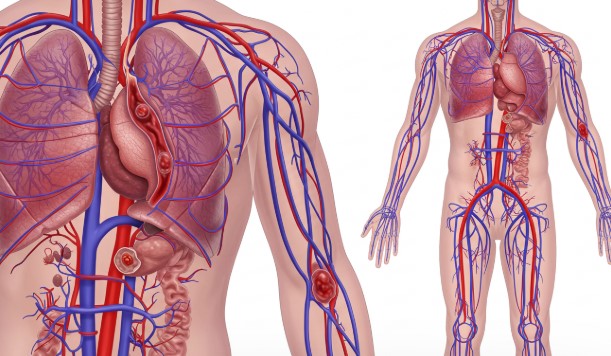 혈전 유발 식품 경고(가공육, 트랜스지방, 설탕)