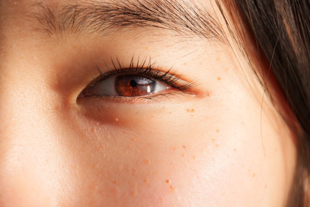 Double eyelid