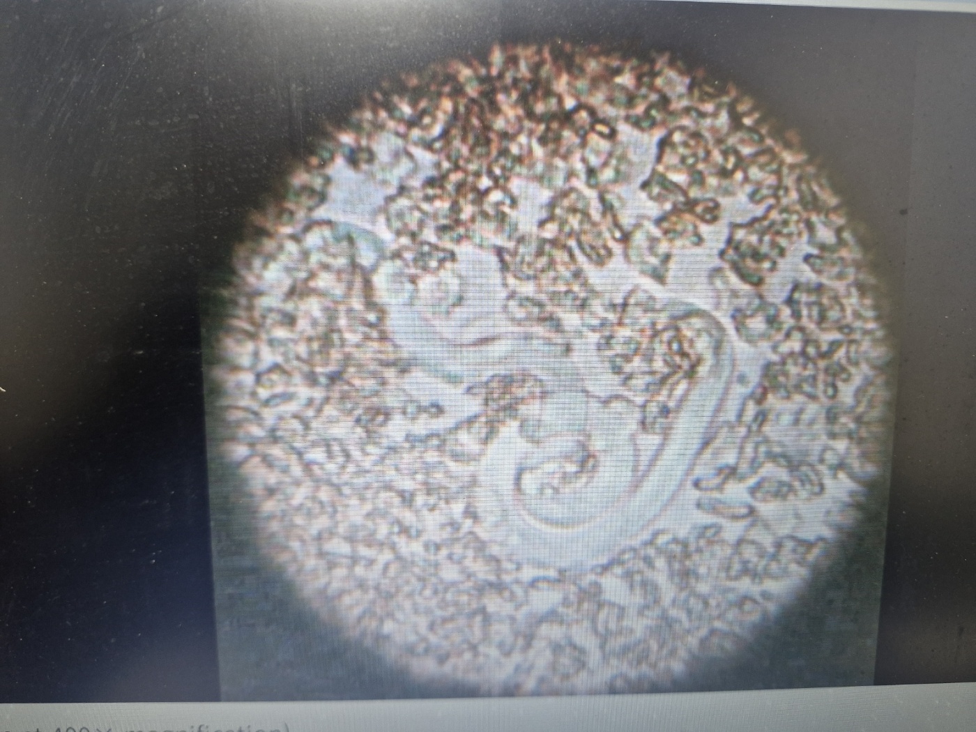 강아지 심장사상충 치료 후기 ...병원비 269만원