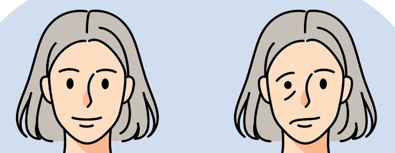 구안와사 초기증상