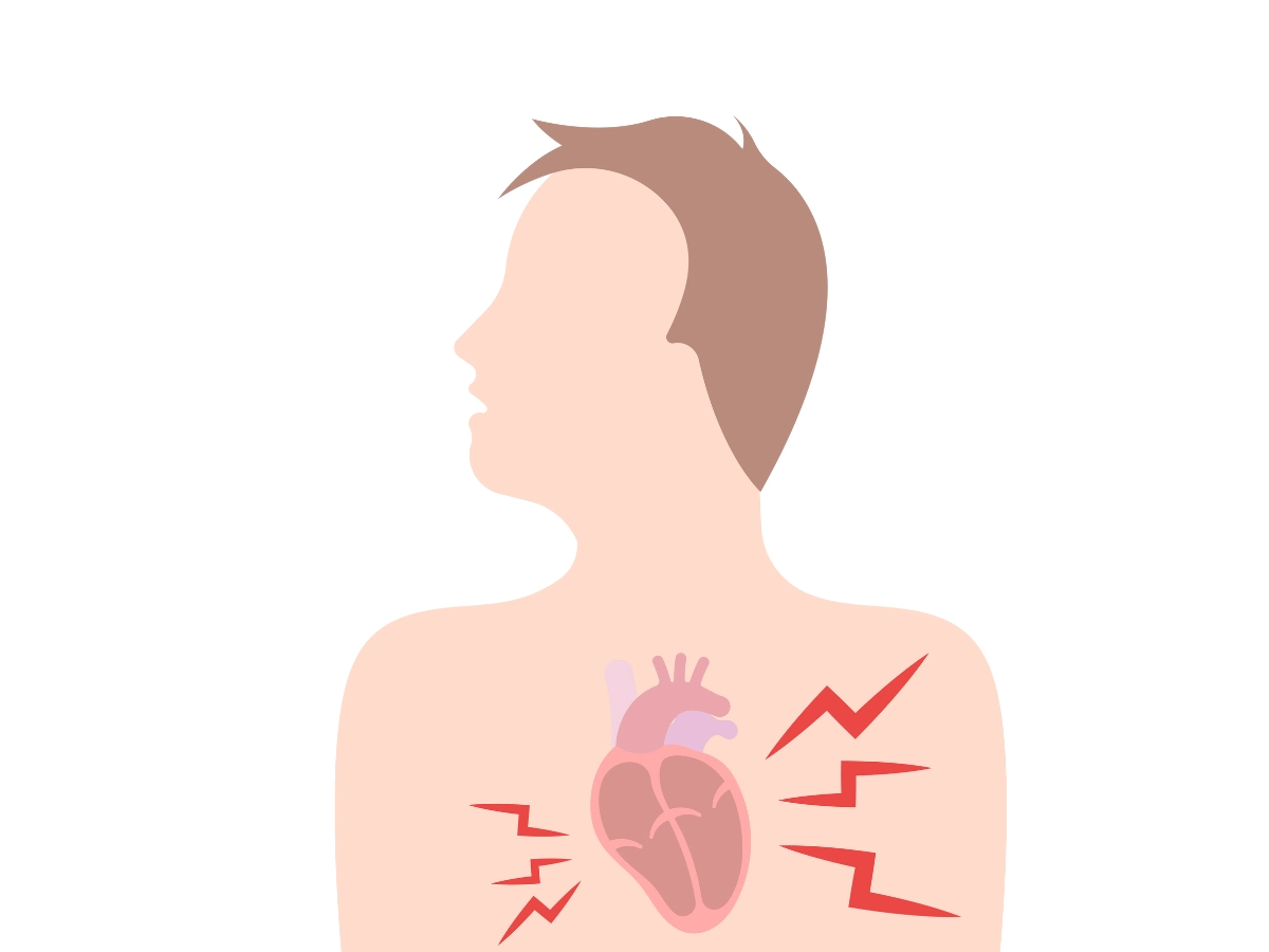 미녹시딜 부작용 심부전