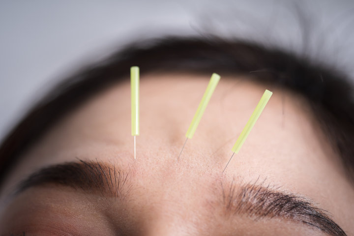 구안와서 초기증상&amp;#44; 안면신경마비 치료 등 총 정리 