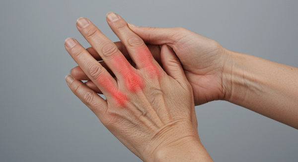 손가락 마디 통증 사진 18