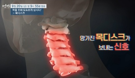 목디스크명의