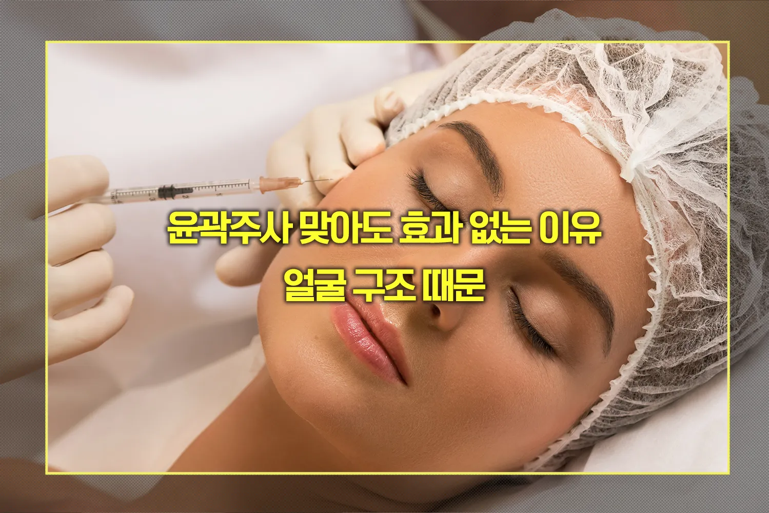 윤곽주사 맞아도 효과 없는 얼굴