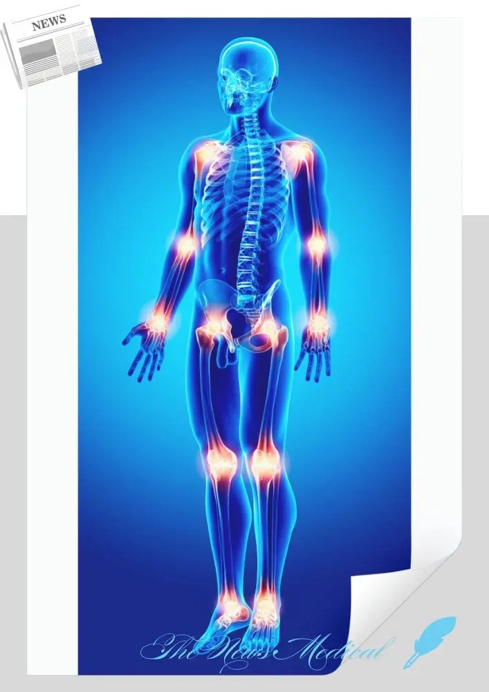 관절은 다양한 구조로 이루어져 있으며, 각각의 구조가 관절의 기능을 수행하고 보호하는 역할을 한다.