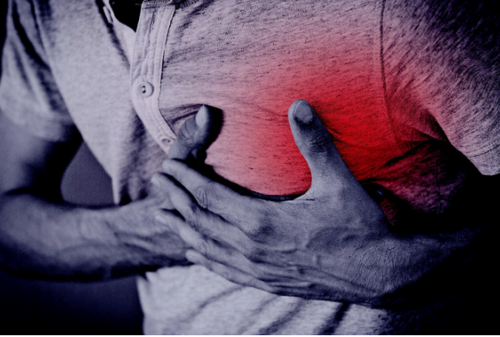 심근경색 가슴통증 이미지사진