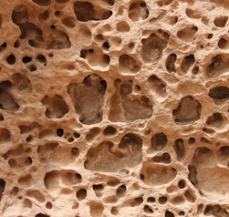 골다공증 초기증상 원인 치료방법