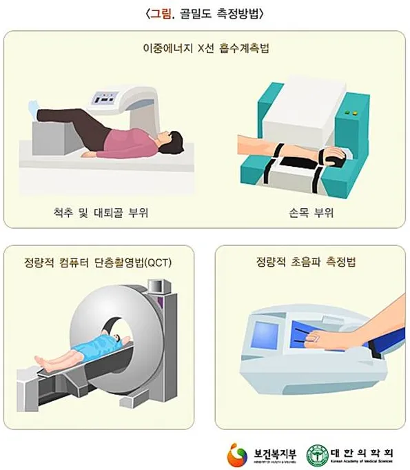 골밀도 검사 수치 골밀도 높이는 방법 간단 정리_8