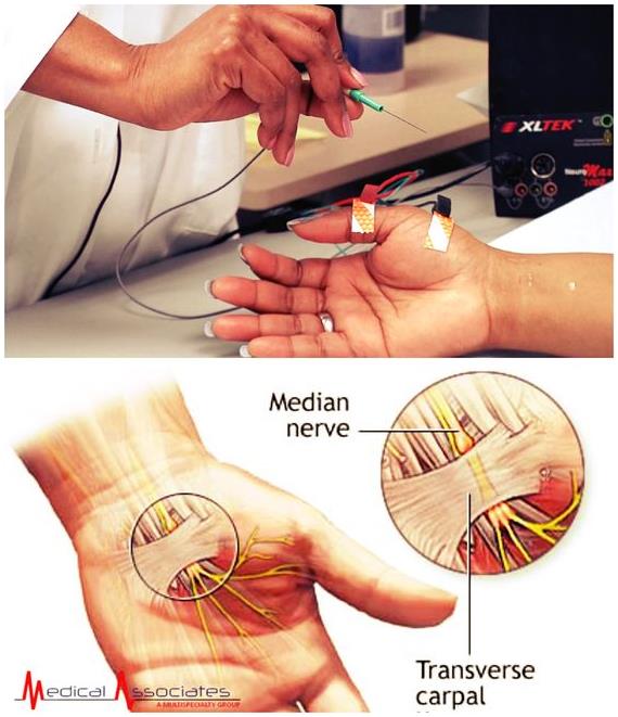 신경 기능 검사