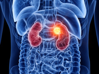 루프스 병 (systemic lupus erythematosus), 전신성 홍반성 원인과 증상에 대해 알아봤습니다. 매우 생소한 이름인데요. 얼굴에 나비 모양으로 발진이 일어났다면 한번쯤은 의심해봐야 합니다. 루프스 병은 어디 병원으로 가야 하는지와 치료방법까지 천천히 읽어 보시기 바랍니다.