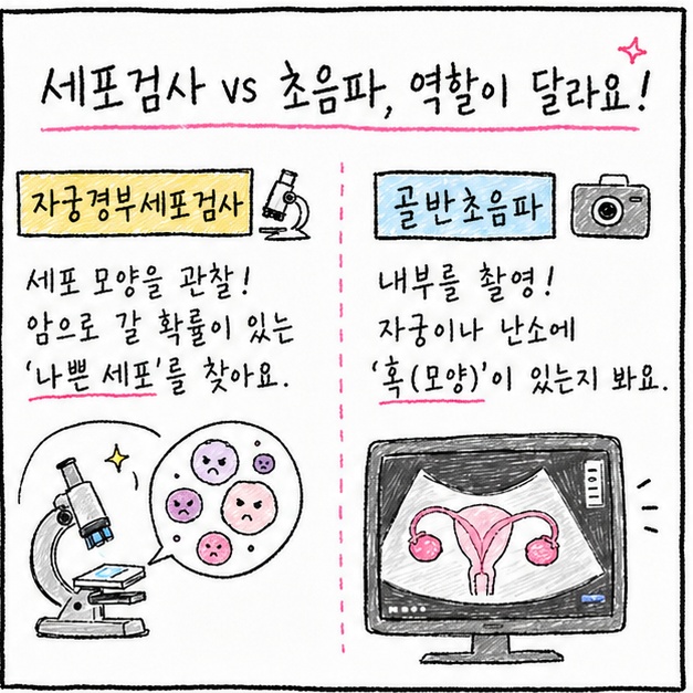 골반초음파 VS 자궁경부세포검사 비교
