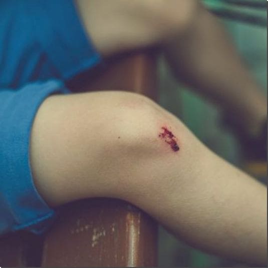 넘어져 다친 아이