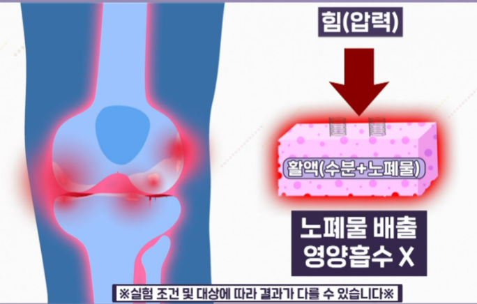 콘드로이친